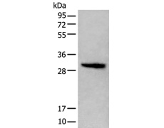 兔抗H1-2多克隆抗体