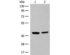 兔抗MRM1多克隆抗体