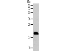 兔抗MRPL12多克隆抗体