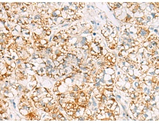 兔抗MRPL20多克隆抗体