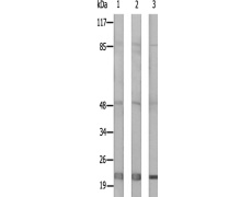 兔抗MRPL32多克隆抗体