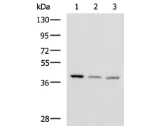 兔抗ENKD1多克隆抗体