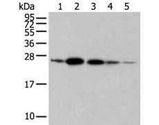 兔抗RAB11A多克隆抗体 