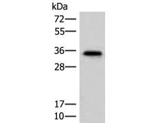 兔抗MS4A1多克隆抗体
