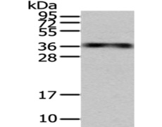 兔抗MSI1多克隆抗体