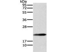 兔抗RAP1A多克隆抗体 