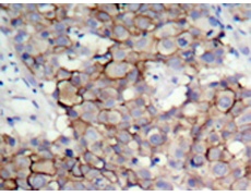 兔抗ERBB2 (Phospho-Tyr877)多克隆抗体