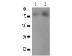 兔抗ERBB2 (Phospho-Tyr1221/Tyr1222)多克隆抗体