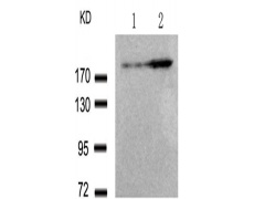 兔抗ERBB2 (Phospho-Tyr1248)多克隆抗体