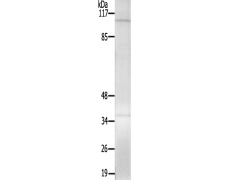 兔抗RB1(Ab-608) 多克隆抗体 