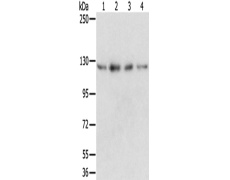 兔抗RBM5多克隆抗体 