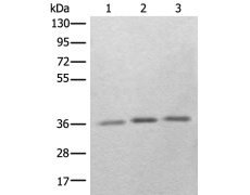 兔抗RBM11多克隆抗体 