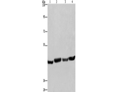兔抗RBMY1A1多克隆抗体