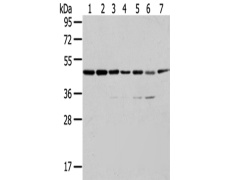 兔抗ERP44多克隆抗体