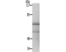 兔抗ESR1(Ab-537) 多克隆抗体