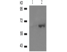 兔抗ESR1 (Phospho-Ser118)多克隆抗体