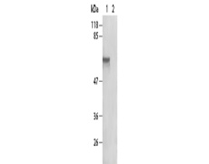兔抗RELA (Phospho-Ser276) 多克隆抗体