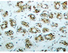兔抗RELA(phospho-Ser311) 多克隆抗体 