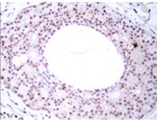 兔抗RELA (Phospho-Thr254) 多克隆抗体 