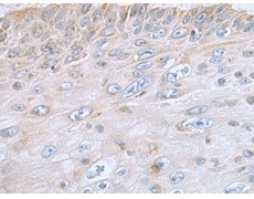 兔抗MMP23B多克隆抗体