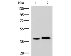 兔抗LPPR5多克隆抗体