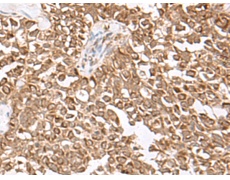兔抗USP16多克隆抗体  