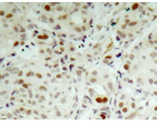 兔抗RB1 (Phospho-Ser807)多克隆抗体  
