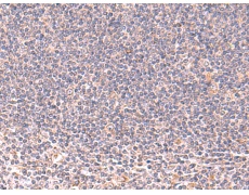 兔抗MANSC1多克隆抗体