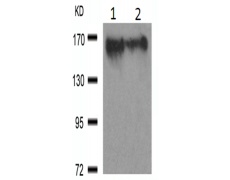 兔抗MAP3K5(Ab-966)多克隆抗体
