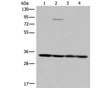 兔抗MRPL1多克隆抗体
