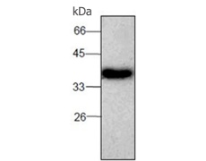 小鼠抗ADK单克隆抗体  