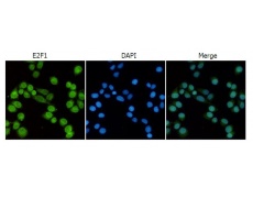 小鼠抗E2F1单克隆抗体   