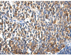 小鼠抗HSP90AA1单克隆抗体 