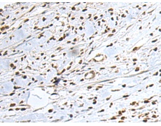 小鼠抗MICU1单克隆抗体