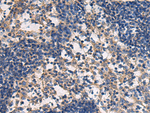 兔抗DMRTA2多克隆抗体