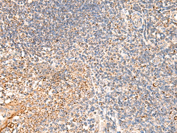 兔抗DUSP7多克隆抗体