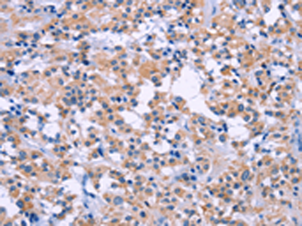 兔抗DUSP22多克隆抗体