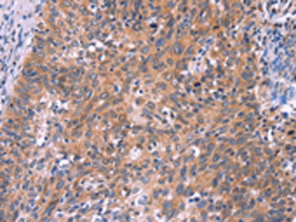 兔抗EDN1多克隆抗体