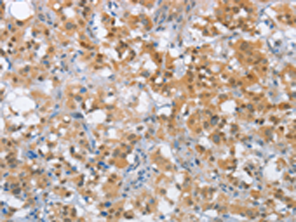 兔抗MLH1多克隆抗体