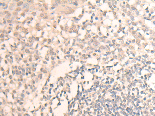 兔抗MLLT6多克隆抗体