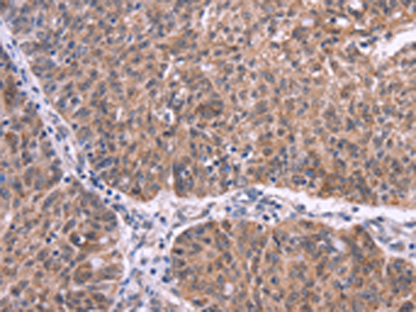 兔抗EFNA5多克隆抗体