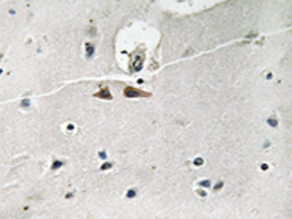 兔抗EFNB1/2/3(Phospho-Tyr324) 多克隆抗体