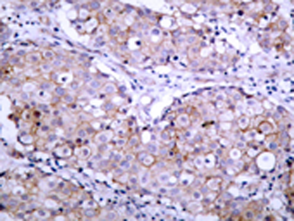 兔抗EGFR (Phospho-Ser1070)多克隆抗体