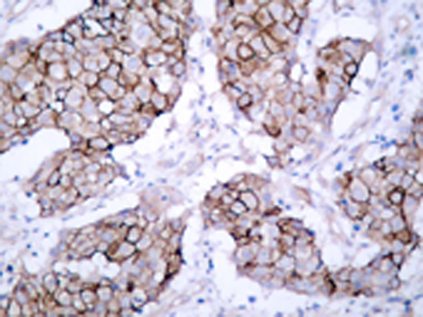 兔抗EGFR (Phospho-Tyr1092)多克隆抗体