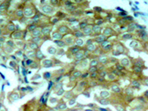 兔抗EGFR (Phospho-Tyr1172)多克隆抗体