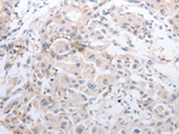 兔抗MMP11多克隆抗体