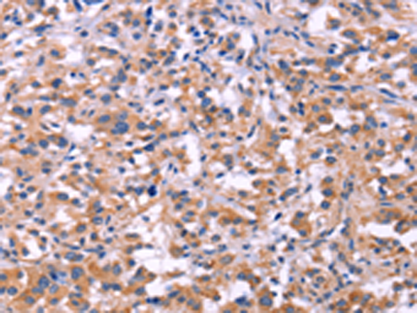 兔抗MMP14多克隆抗体