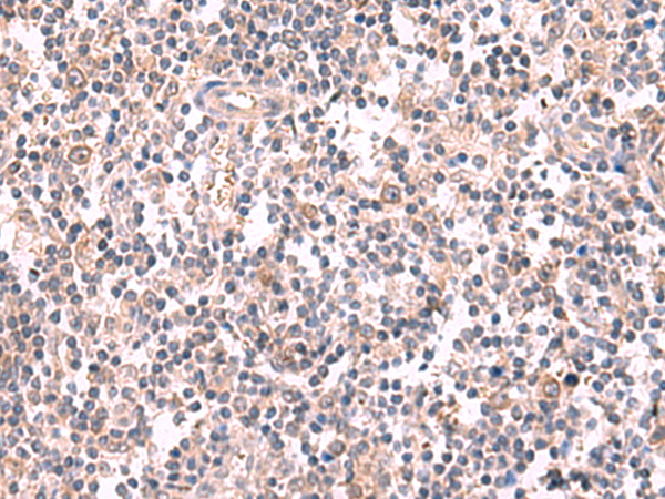 兔抗GSPT2多克隆抗体 