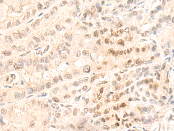 兔抗GTF2F1多克隆抗体 
