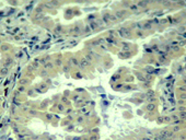 兔抗EIF4G1 (phospho-Ser1232)多克隆抗体